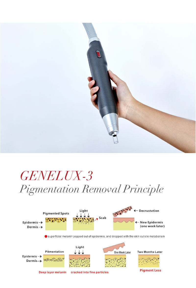 Different Color Tattoo Removal Skin Care Rejuvenation Beauty Machine