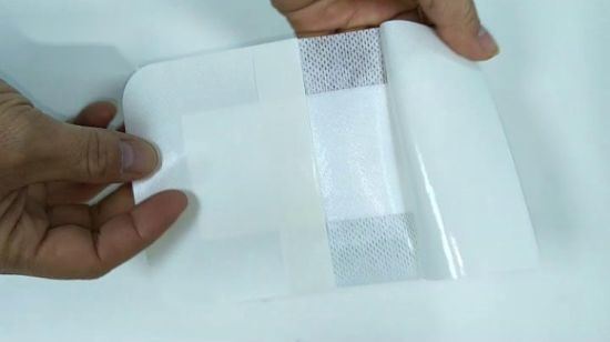 Medical Surgical Adhesive Non Woven Wound Plaster Dressing