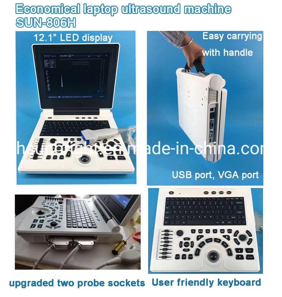 Portable Laptop Color Ultrasound Scanner, Ultrasound 2 Probes Connector