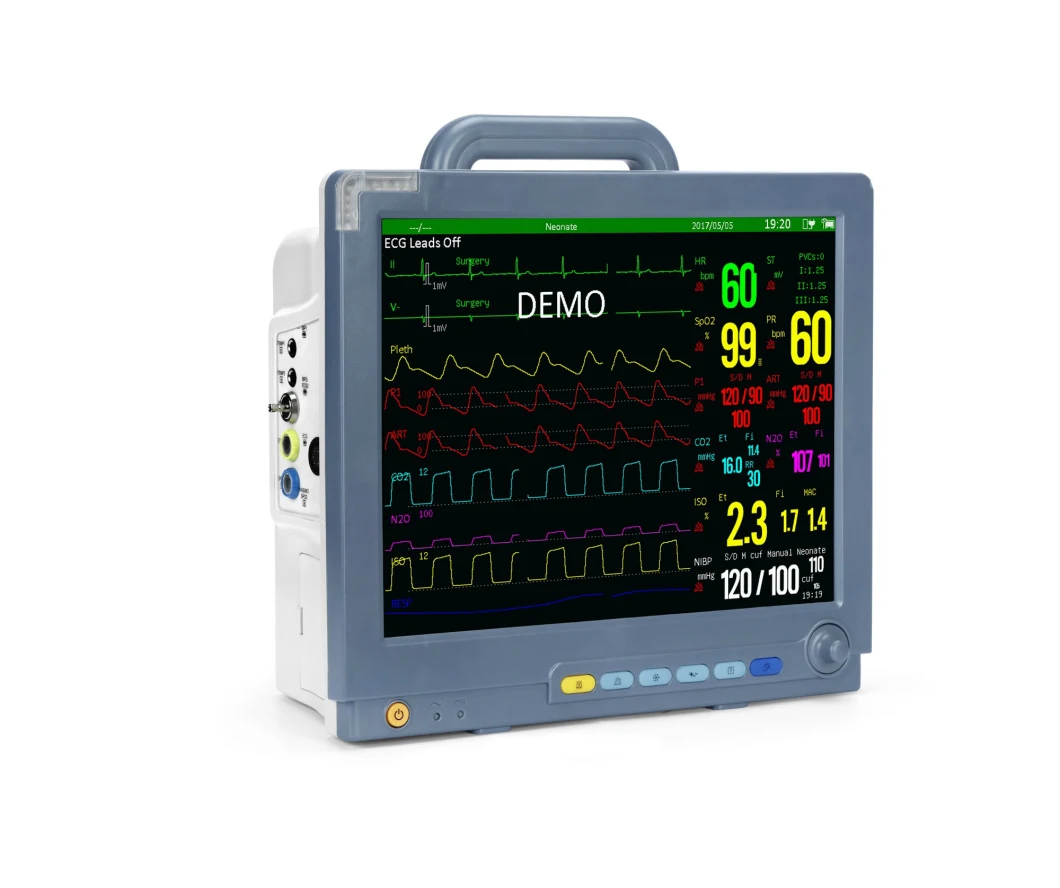 Sinnor 15inch Portable Patient Monitor with WiFi Centre System (SNP9000M) /ECG Monitor/Cardiac Monitor