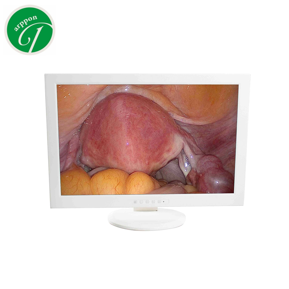 21 Inch Medical Monitor for Endoscope Camera System Surgical Display Monitor Endoscopy Medical Monitor