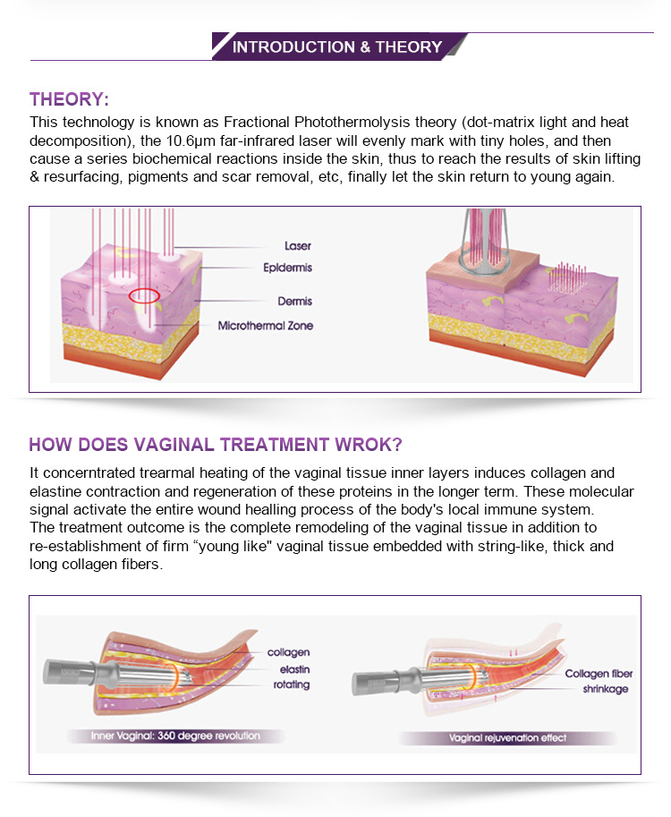 Laser CO2 Fractional/Laser Resurfacing/Scar Removal Surgical Laser