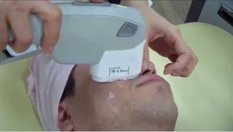 Ultrasound Hifu Medical Beauty Equipment for Skin Tighten