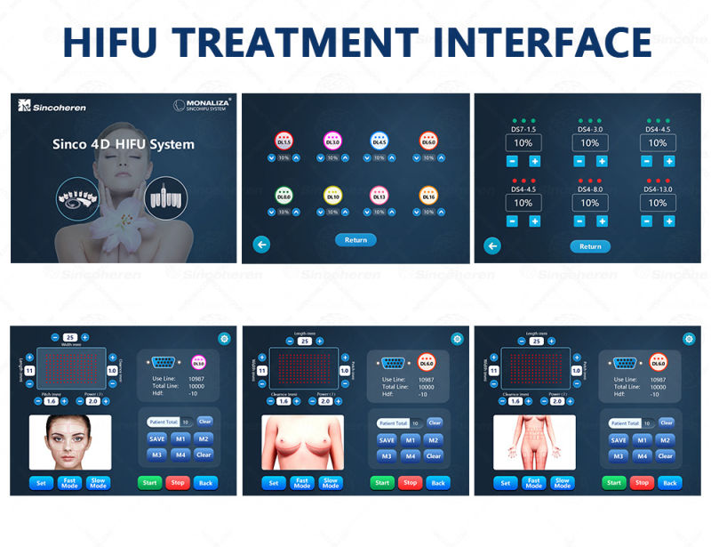 Korea Powerful 3D 4D Hifu /Portable Hifu Face Lift Machine