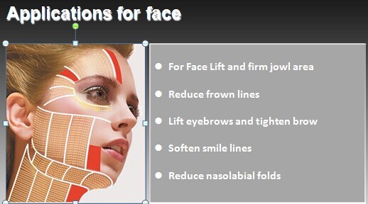 Beauty Machine Ultralift Hifu for Skin Tightening/ Face Lifting