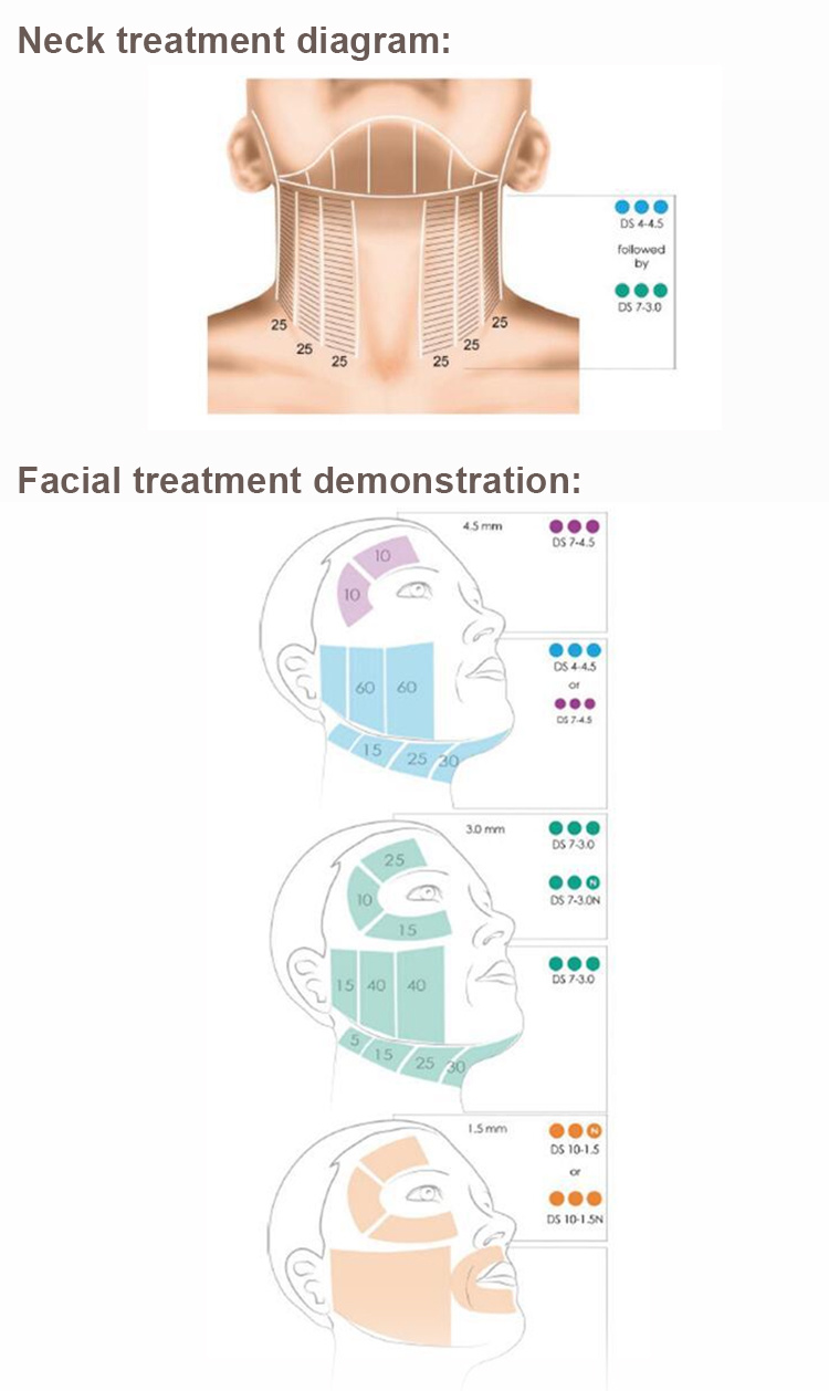 Face Lift Facial Care Fat Removal Ultrasound Hifu Machine for Body Slimming