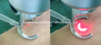 Clinic Salon Equipment CO2 Fractional Laser for Acne Scar Treatment