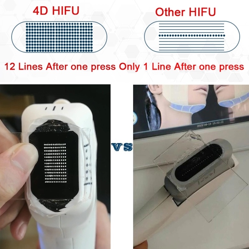 New Technology 2019 2 in 1 Portable 4D Hifu Vmax Hifu Focused Ultrasound Face Lifting Hifu Machine