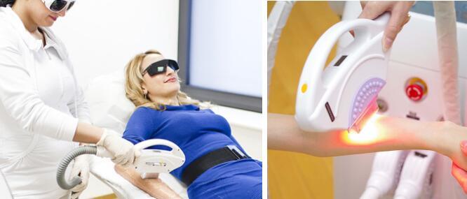 Painless Opt Laser Hair Removal IPL Painfree and Skin Care