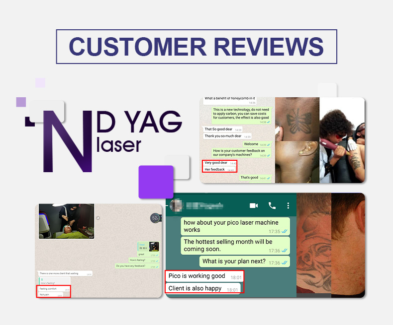 Powerful Laser Tattoo Removal Isntrument Q Switch ND YAG Laser Beauty SPA Instrument