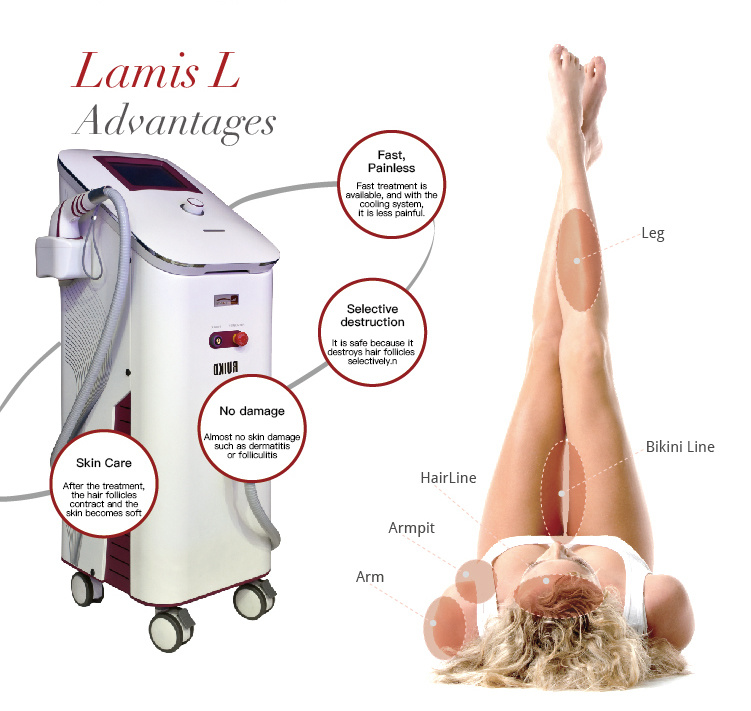 FDA Approved 808nm Diode Laser for Hair Removal Beauty Machine