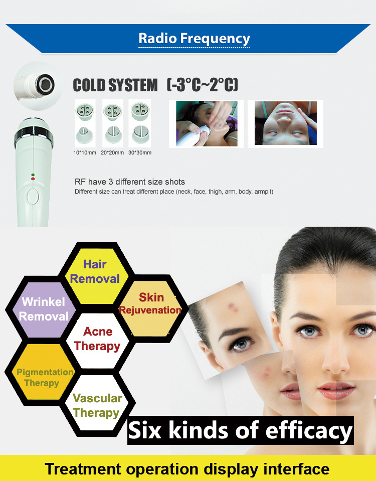 IPL Shr Hair Removal Device with RF Skin Tightening Function