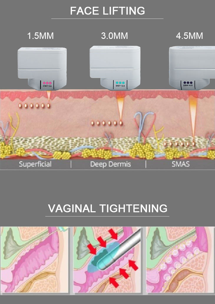Ultrasound Manufacturers Face Lifting Vaginal Tightening Hifu Beauty Machine