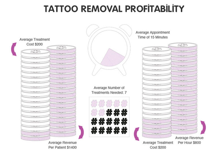Professional Q Switch ND YAG Laser Low Price Skin Resurface Laser Machine Tattoo Removal