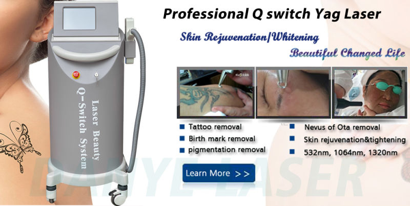 Beauty Equipment Q Switch ND YAG Laser Machine Carbon Peel Tattoo Removal Laser ND YAG