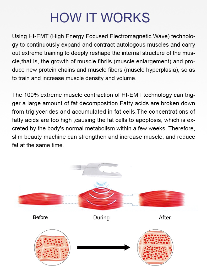 Factory Price Muscle Building Fat Removal Electromagnetic Machine for Sale