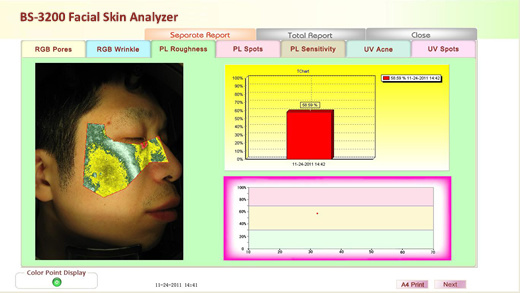 3D Facial Skin Analyzer Magnifier Machine with 3 Spectrum