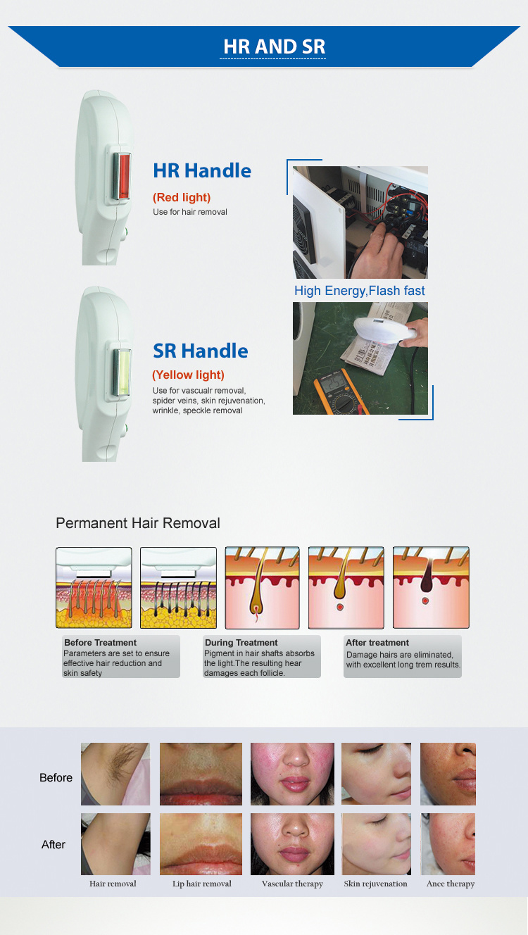 High Quality Double Handle Permanent Hair Removal IPL Shr Machine
