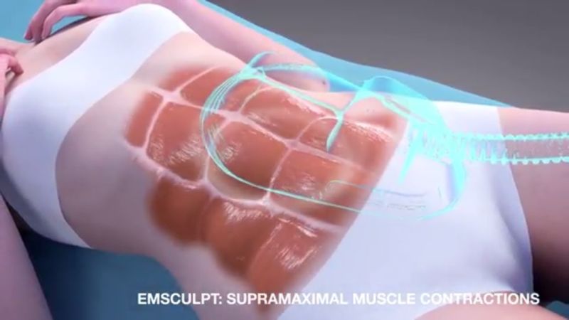 Portable EMS Muscle Sculpt Body Slimming Machine Hiemt Muscle Stimulator