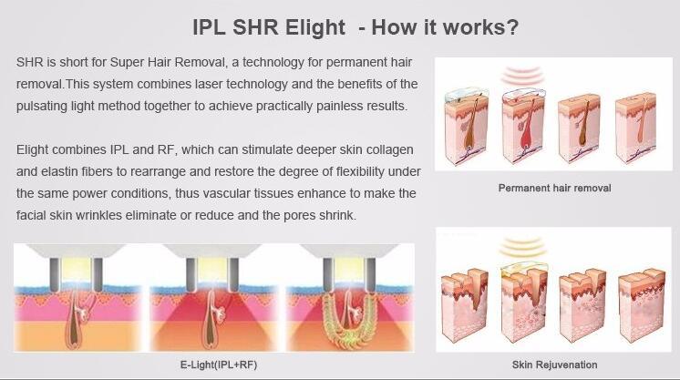 Multifunctional Shr Opt IPL/IPL Laser/IPL Tattoo Hair Removal