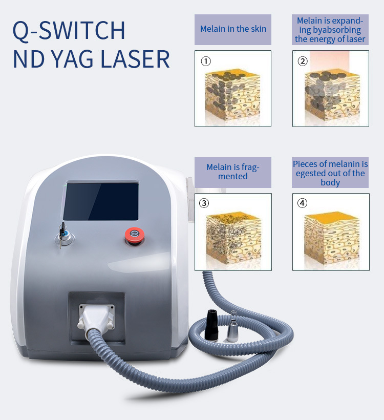 New Design ND YAG Laser Q-Switch Tattoo Pigmentation Removal Beauty Equipment