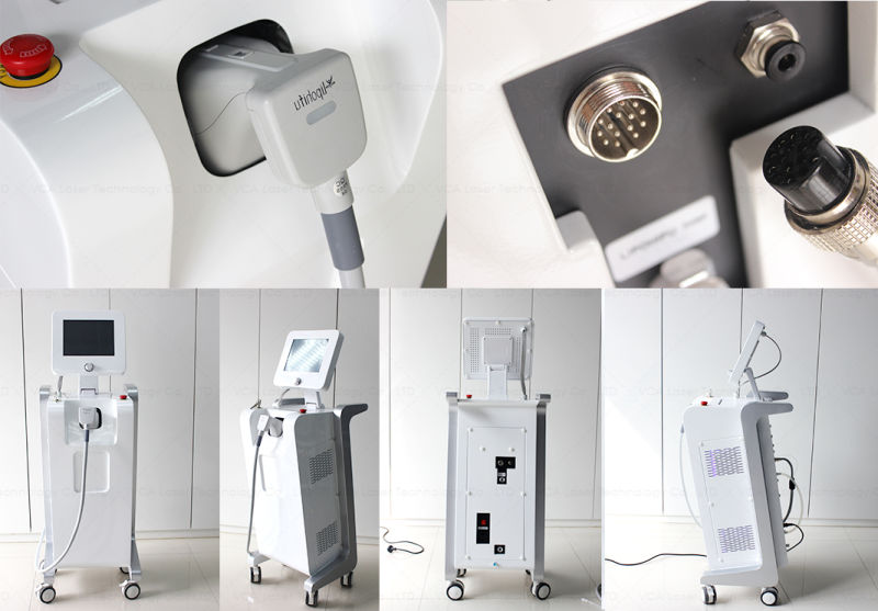 Hifu Beauty Machine Hifu Ultrasonic Slimming System for Body Shaping