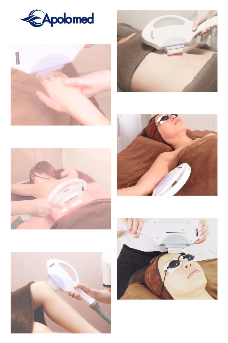 Vertical Hair Removal &Spider Veins Removal IPL Beauty Equipment
