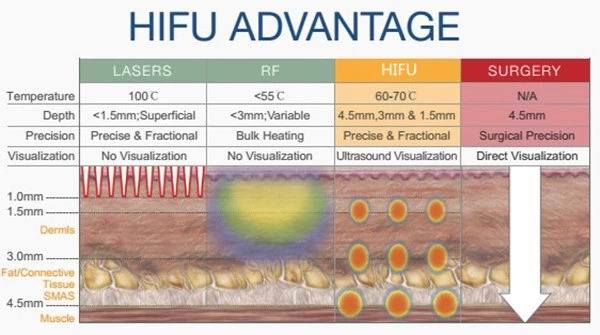 Hifu Ultrasound Wrinkle Removal Machine 3D Hifu Body Slimming