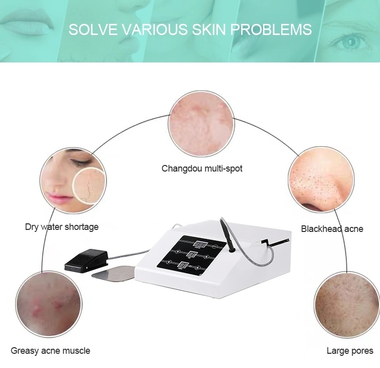 Guangzhou Factory Portable Acne Removal Beauty Machine for Salon