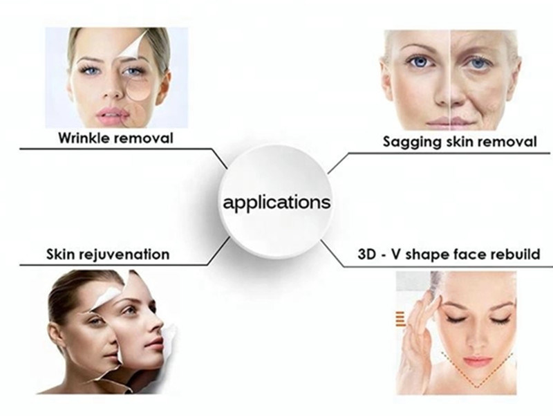 Professional Beauty Equipment Hifu Machine for Face Lifting (VS-912)