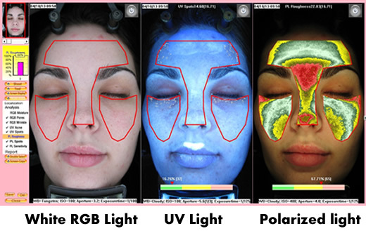 Professional Portable BS-3200 3D Facial Skin Analyzer Magnifier Machine