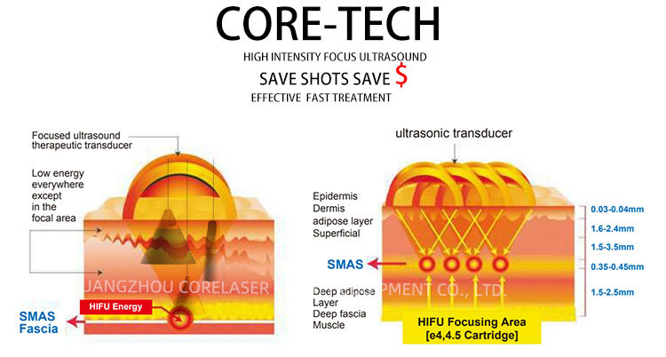 Salon Use Smas Hifu Face Lift Beauty System / Hifu High Intensity Focused Ultrasound