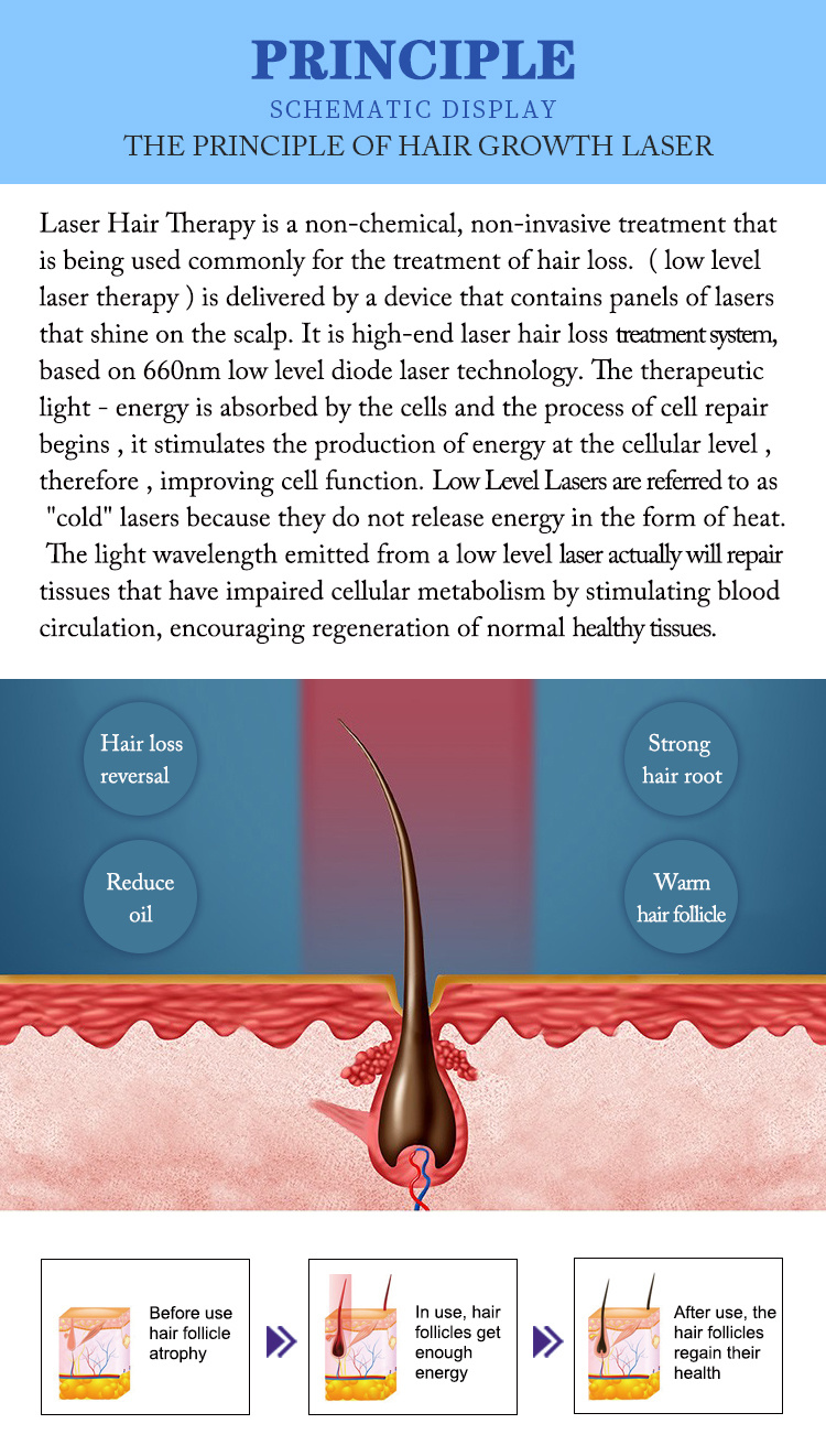 New Coming Hair Growth Hair Loss Treatment LED PDT Machine