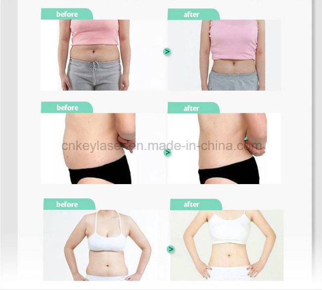 Velashape Body Slimming Weight Loss Machine/Velashape Body Shaping/Vela Shape