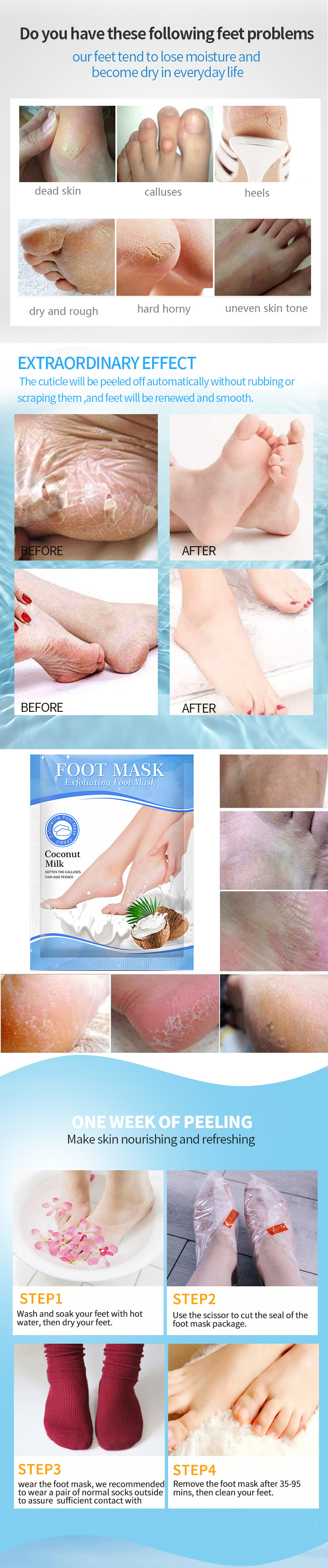 Exfoliating Foot Mask Cosmetics Acne Cleanser Best Serum for Acne