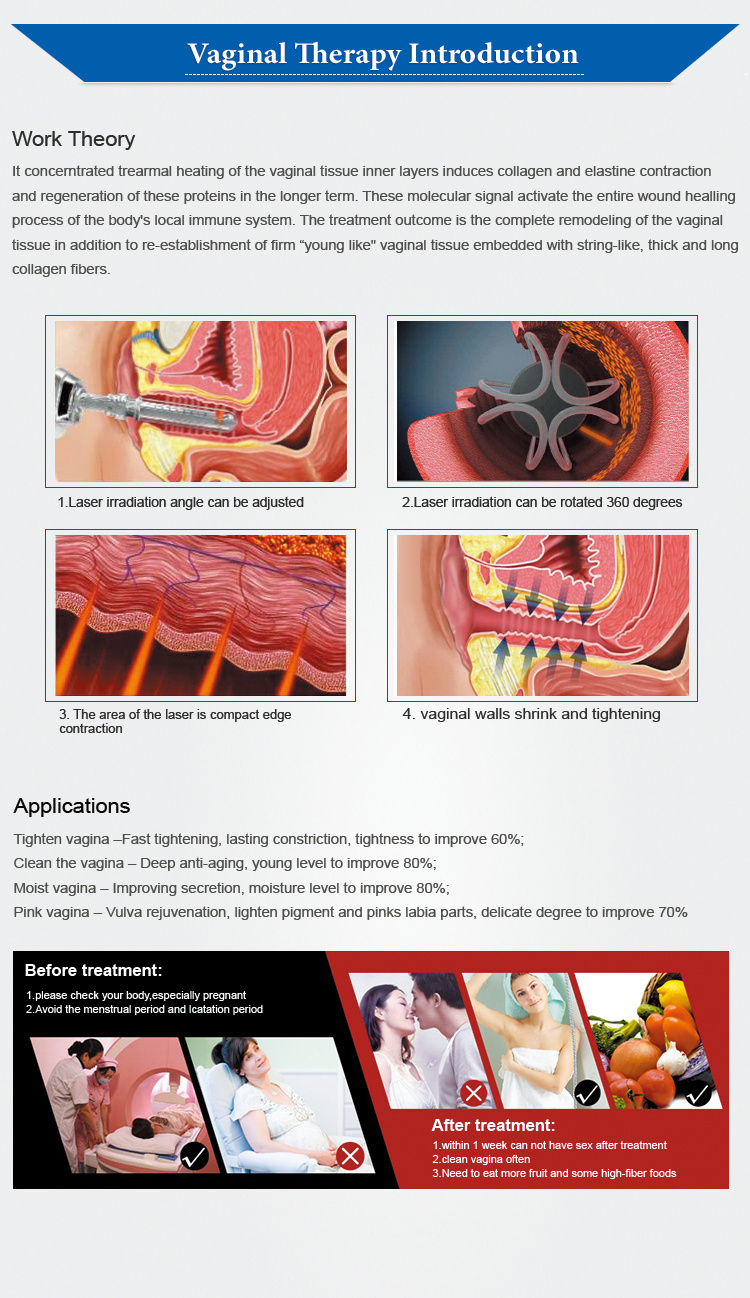 Ce Fractional CO2 Laser Machine with Three Systems: Cutting/Fractional/Vaginal Treatment