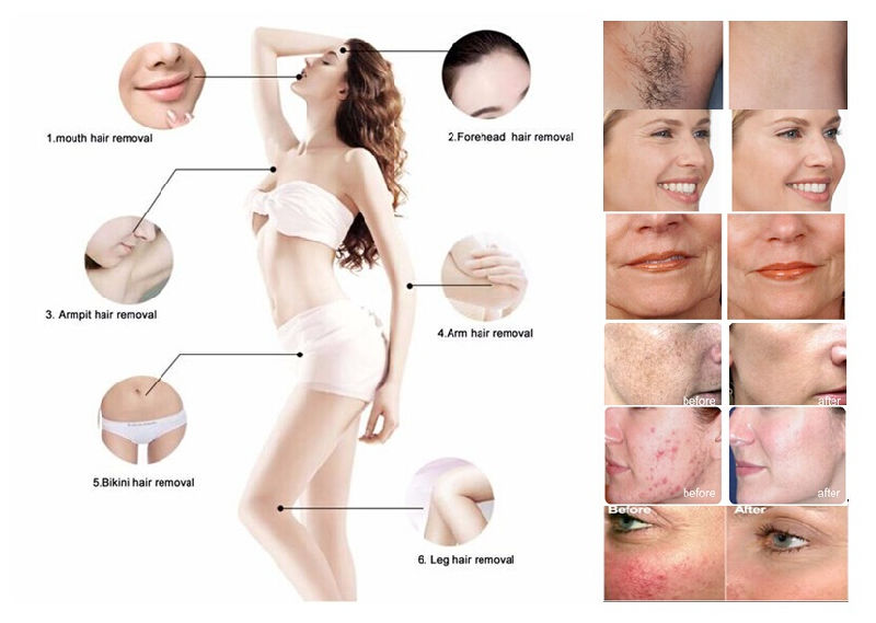 Professional Hair Removal IPL Shr Machine IPL Shr Opt Machine IPL Opt Device for Permanent Hair Removal Laser