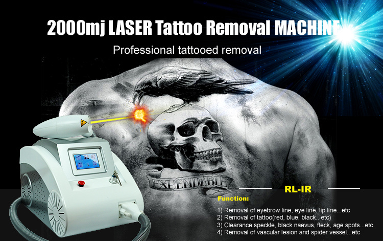 Portable Laser Tattoo Remove Machine Q Switch ND YAG Laser