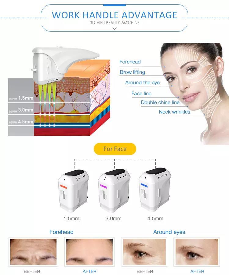 1, 000, 000shots 5D Ice Cooling Hifu V-Max 4D Hifu 3D Hifu Face Lifting Body Slimming Beauty Machine Hifu Machine/ Hifu Skin Lifting