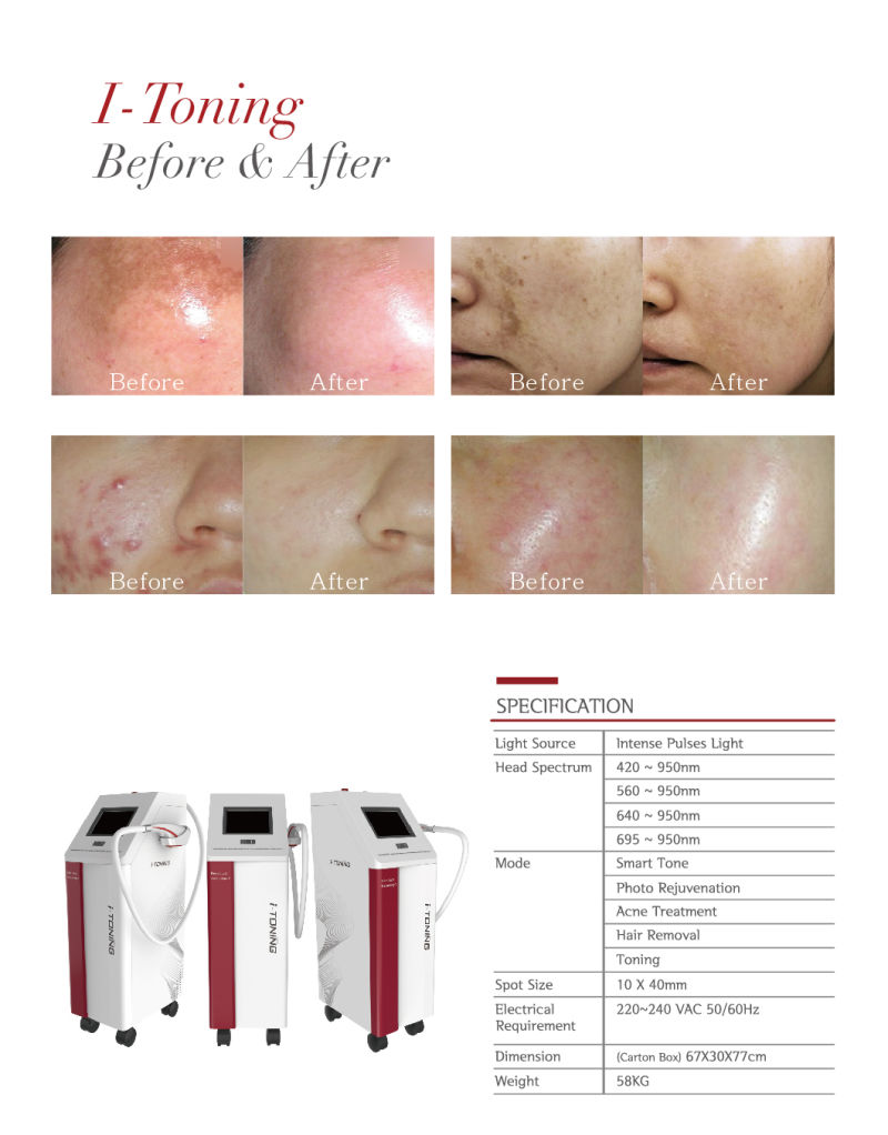 Elight Hair Removal and Pigment Removal Skin Care Remove Acne/Acen Removal Elight IPL Machine