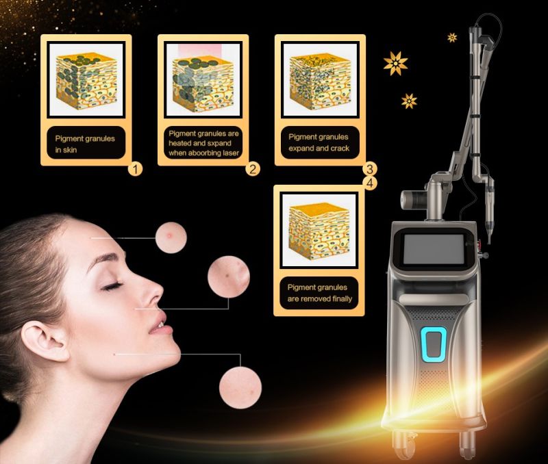 2021 Picosecond Laser Tattoo Removal Ink Pigmention and Birth Mark Removal Machine Q Switched ND YAG Laser Machine