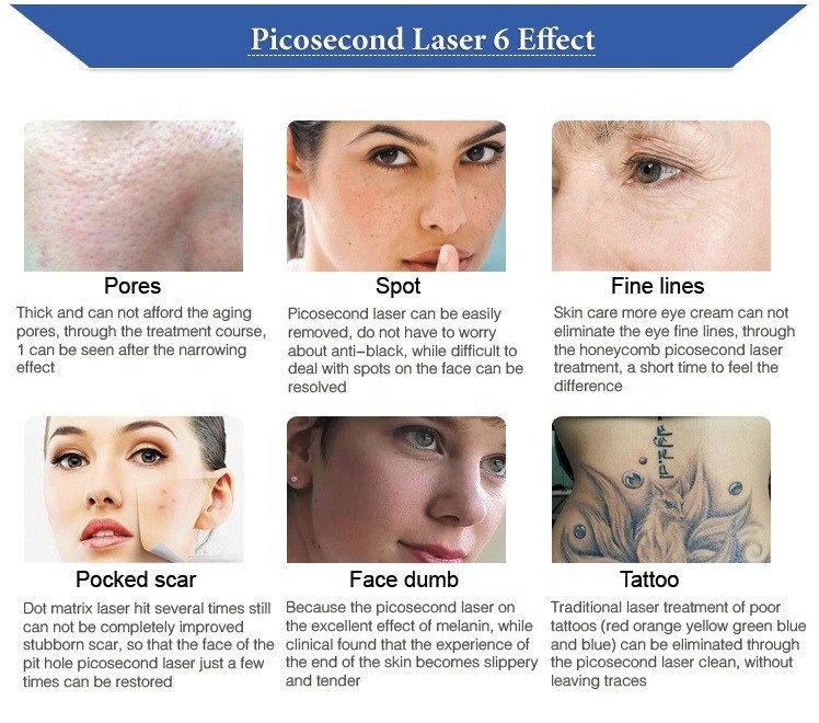 Laser Picosecond Machine 2021 Portable Removing Tattos Q Switched ND YAG Laser Skin Beauty Apparatus