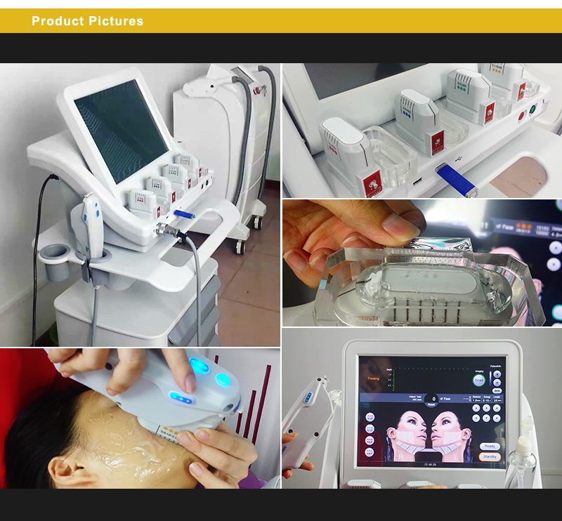Newest Hifu Machine for Face Lift /Wrinkle Removal/Body Shape