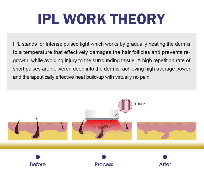 Opt IPL+Elight+RF Multifunctional IPL Hair Removal Opt Shr IPL Laser Hair Removal