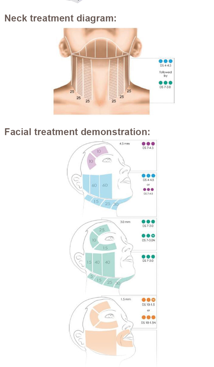 Hifu Vaginal Tightening and Facial Rejuvenation for Painless Female Private Care Beauty Equipment