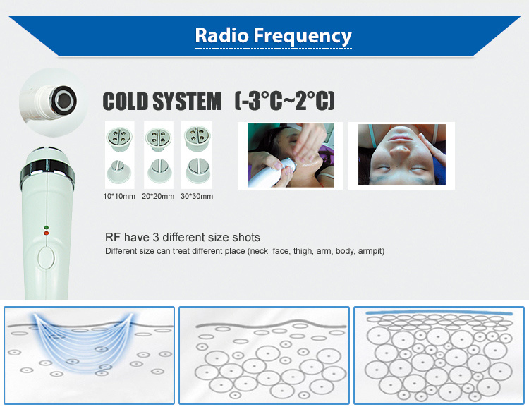 RF Face Lifting / Laser Tattoo Removal / IPL Hair Removal Multifunction Device