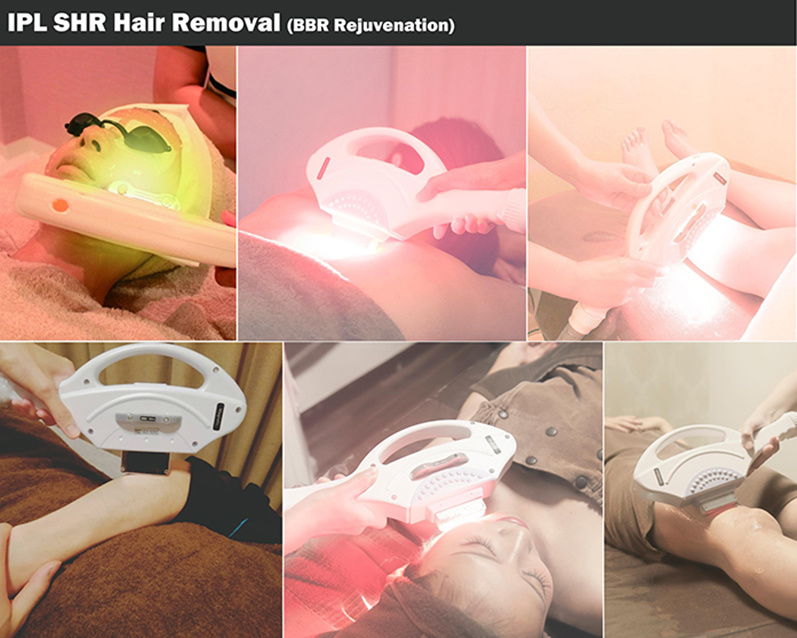 Vertical Hair Removal &Spider Veins Removal IPL Beauty Equipment