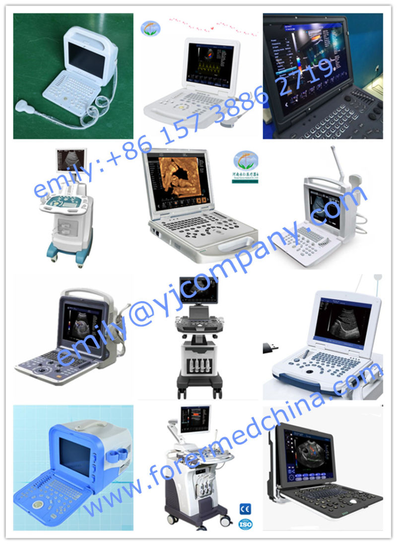 Medical Instrument B/W Digital Ultrasound System at Low Price
