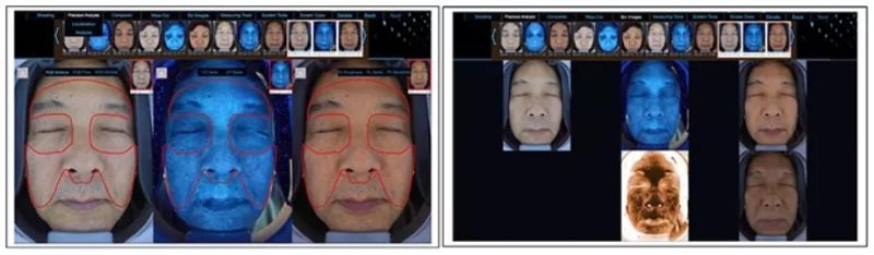 3D Digital Professional Magic Facial Skin Analyzer Beauty Machine