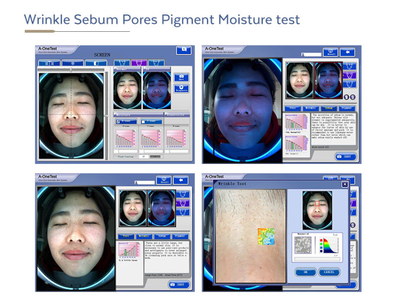 Portable 3D Visia Facial Skin Analysis Machine